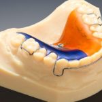 3D-Printing-Dental